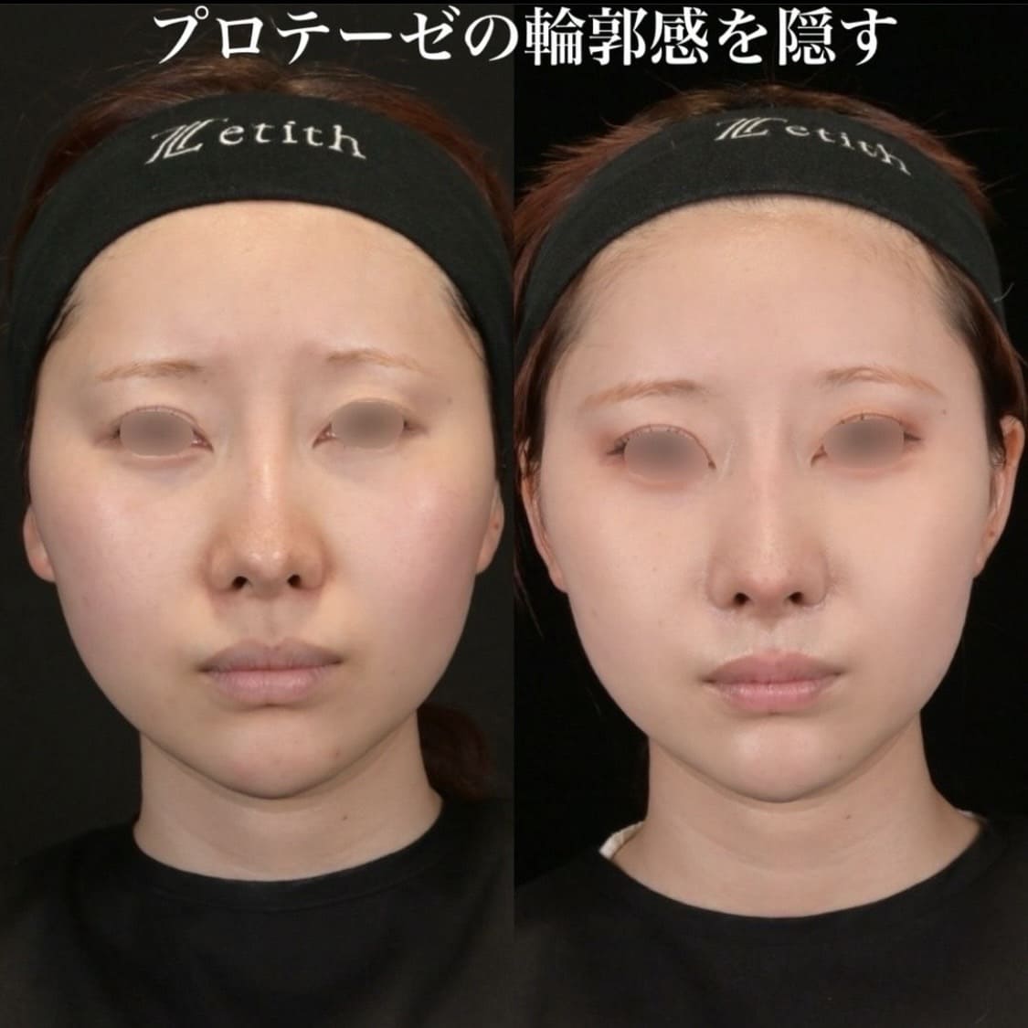症例写真