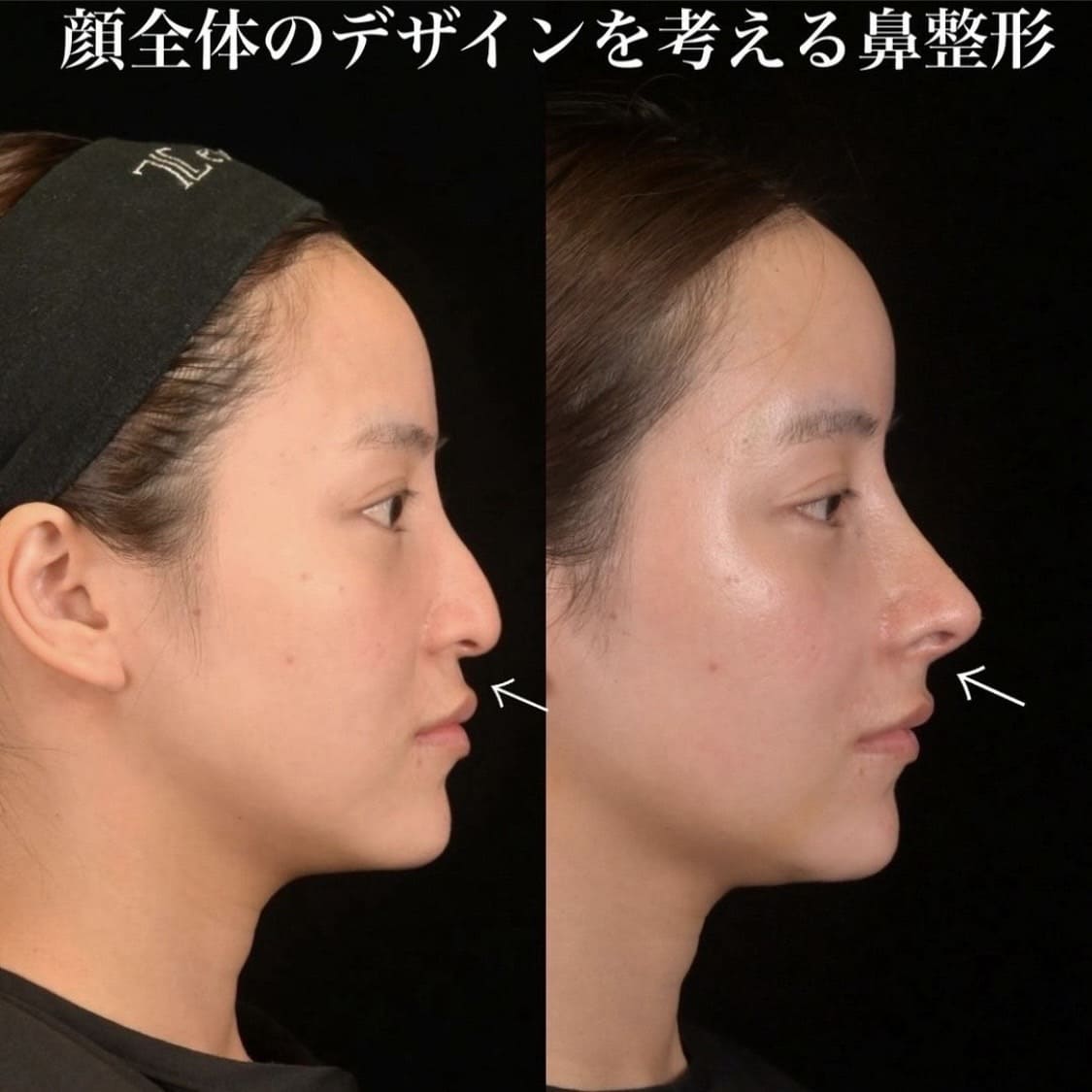症例写真