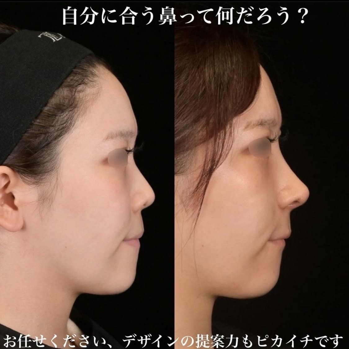 症例写真