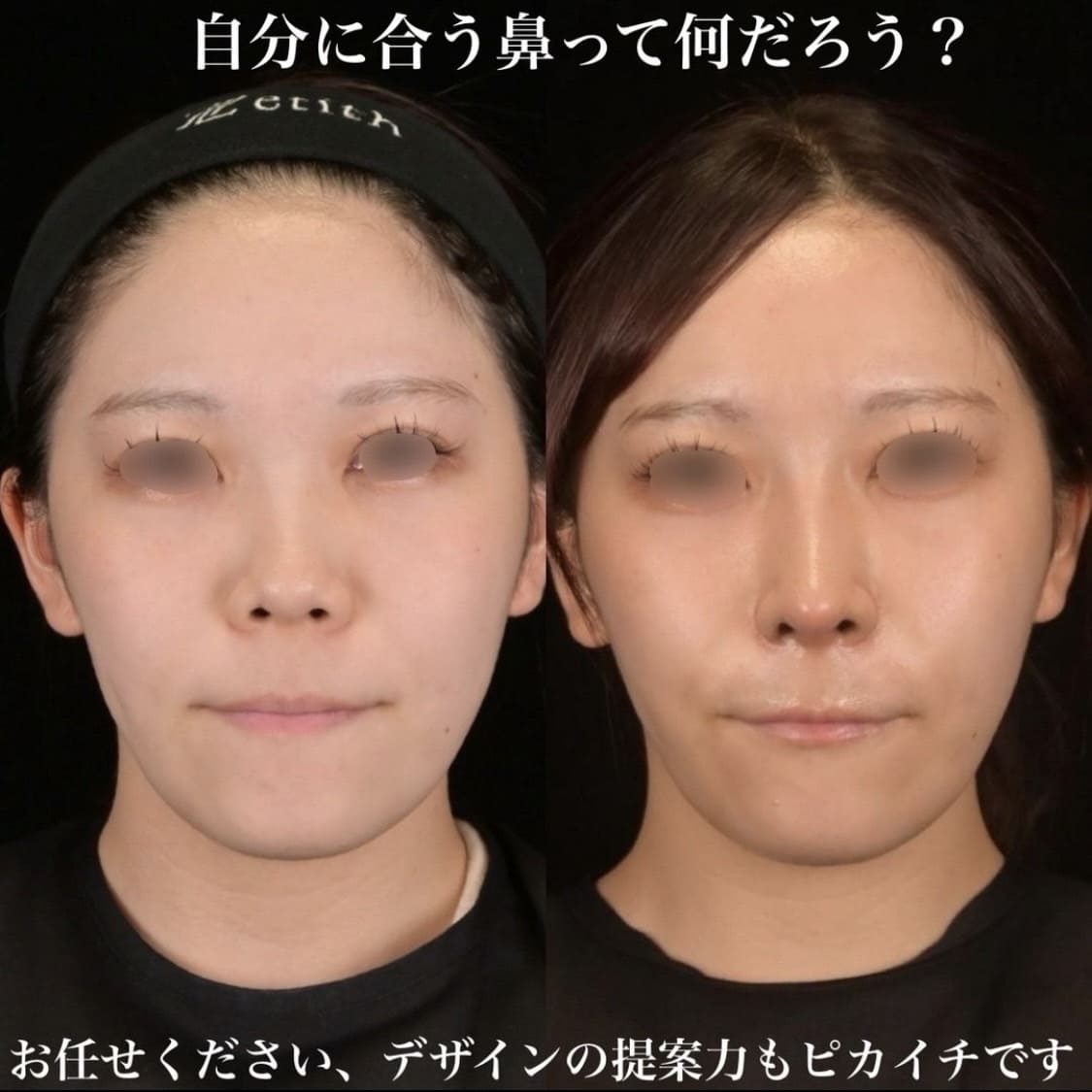 症例写真