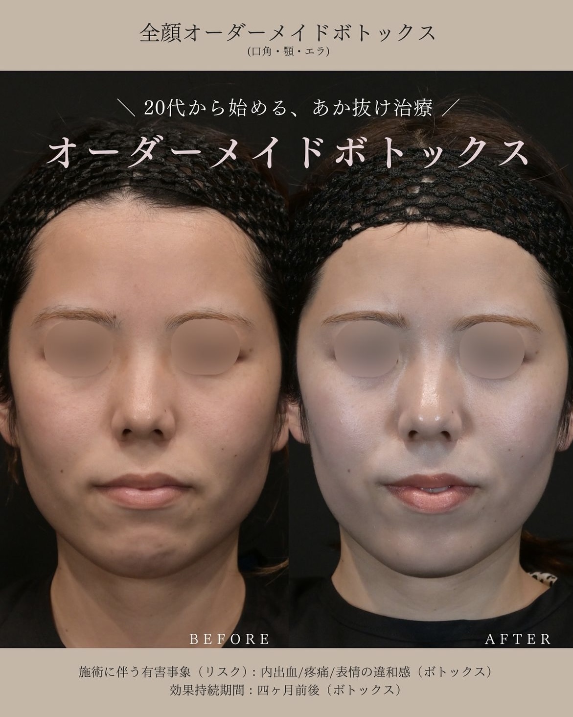 症例写真