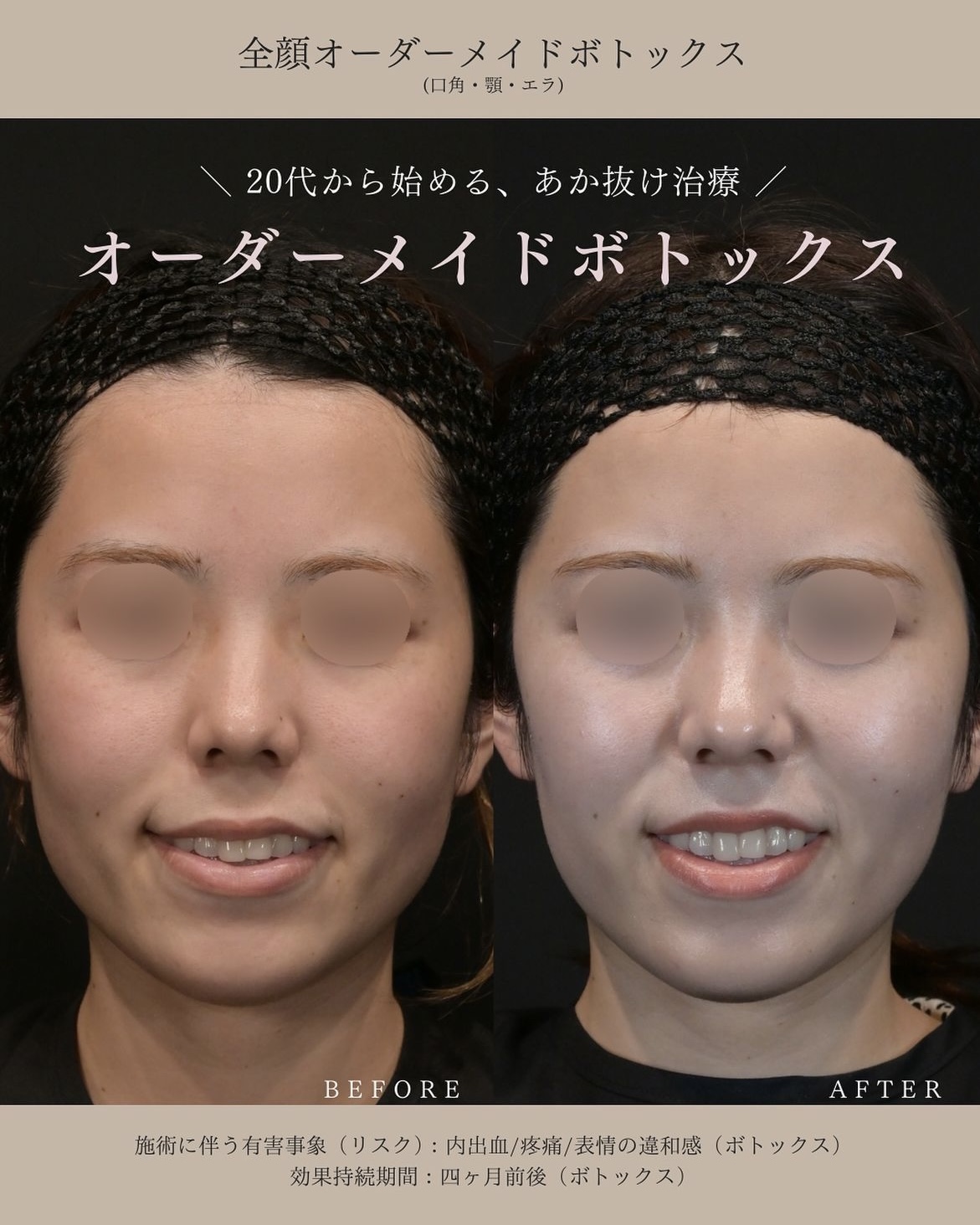 症例写真