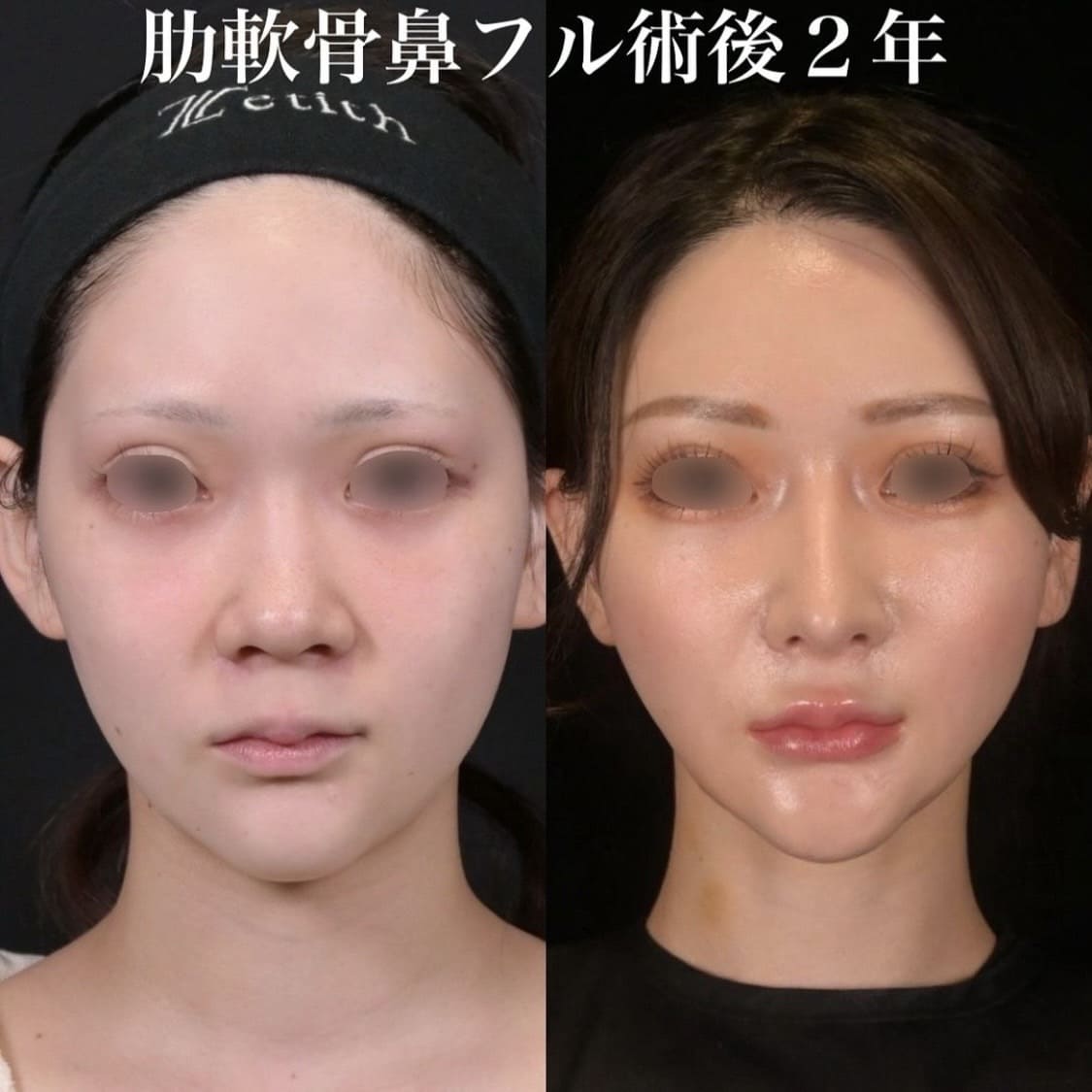 症例写真