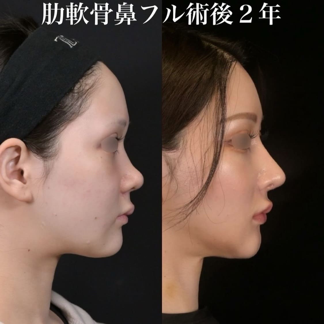 症例写真