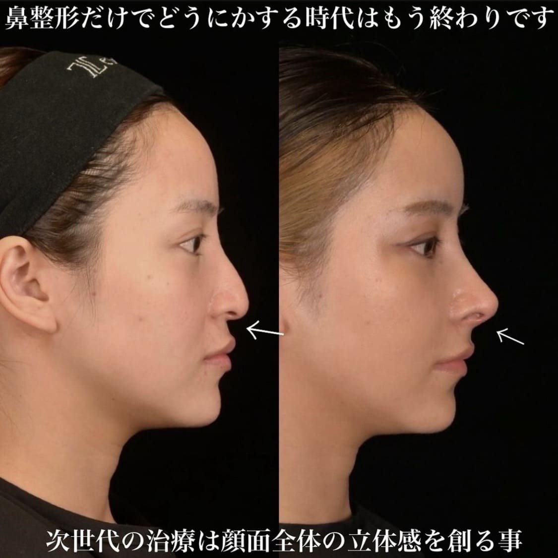 症例写真