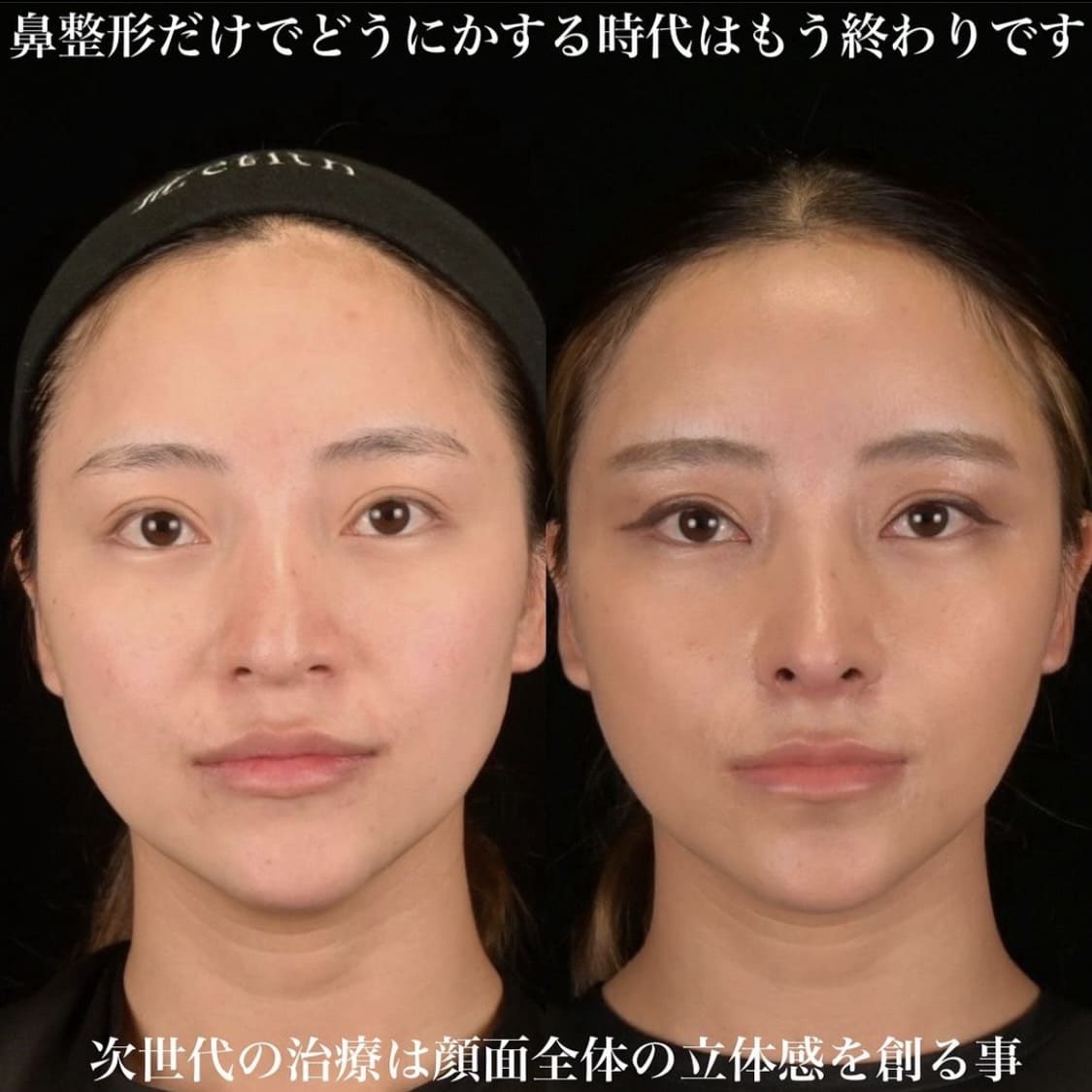 症例写真