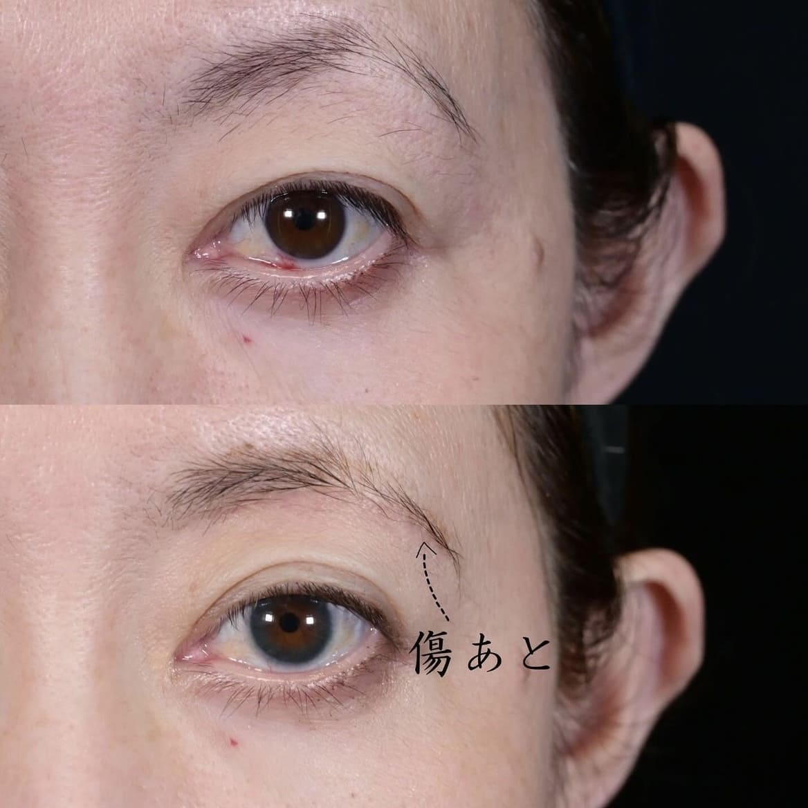 症例写真