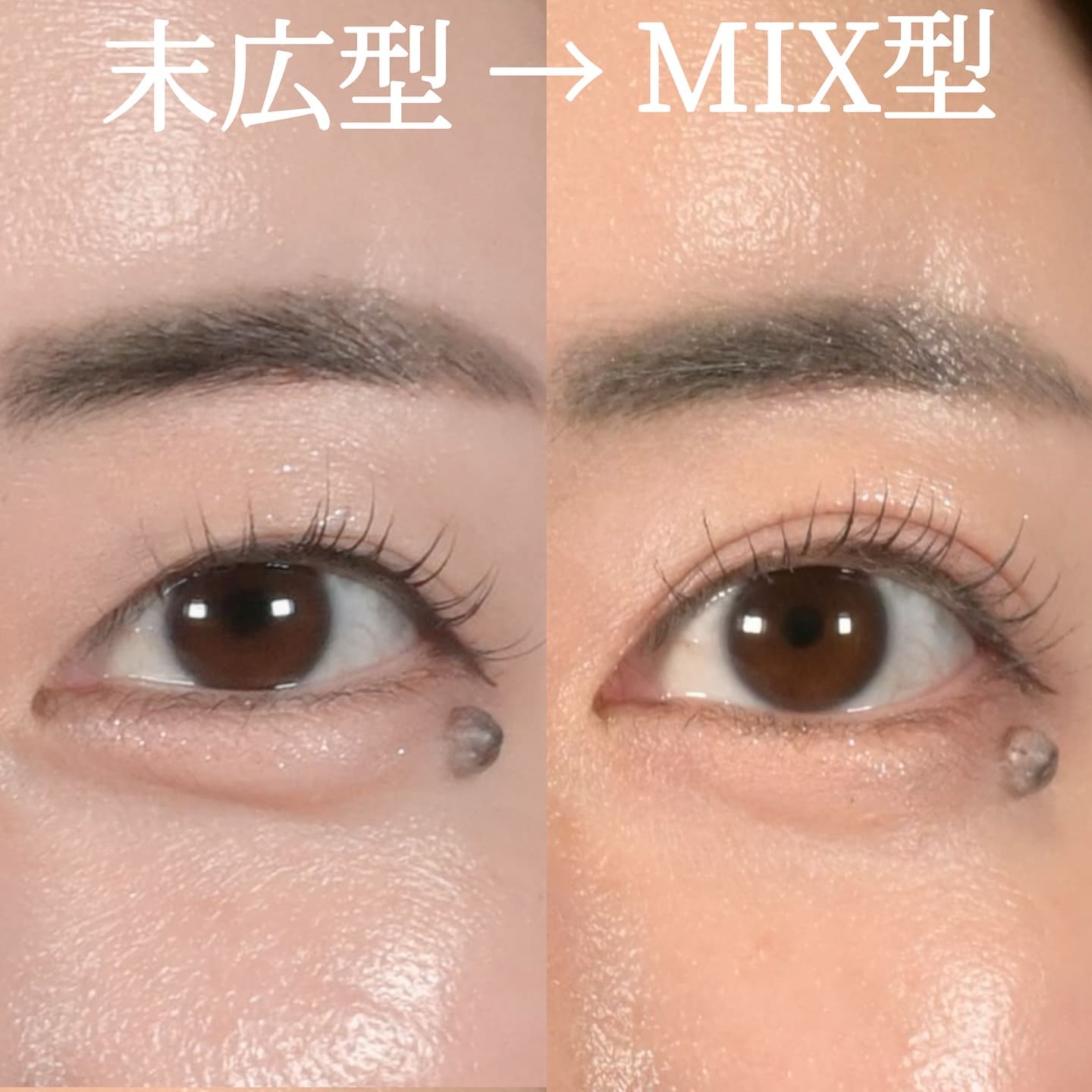 症例写真
