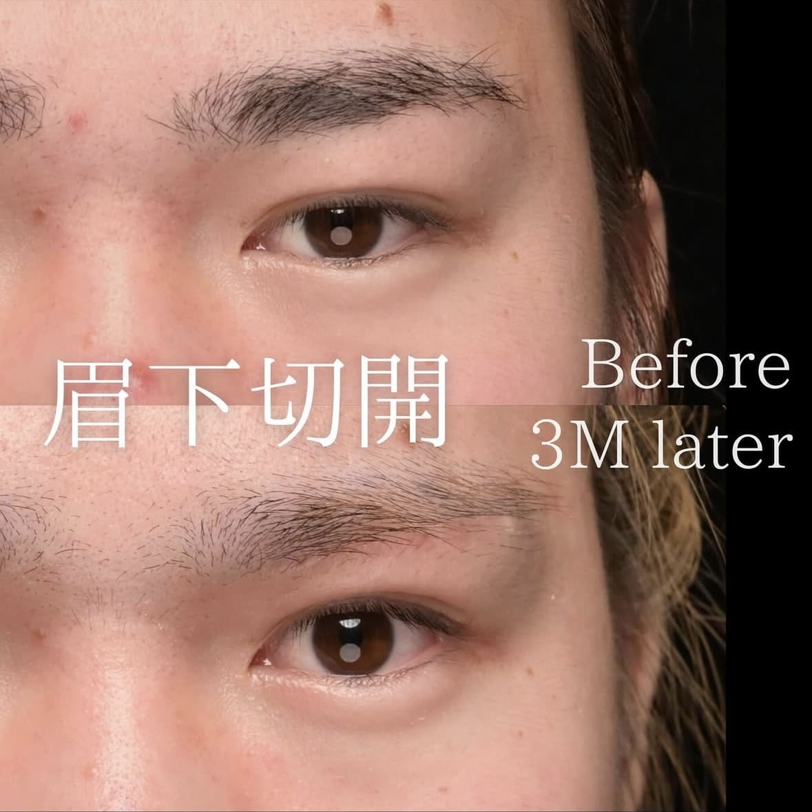 症例写真