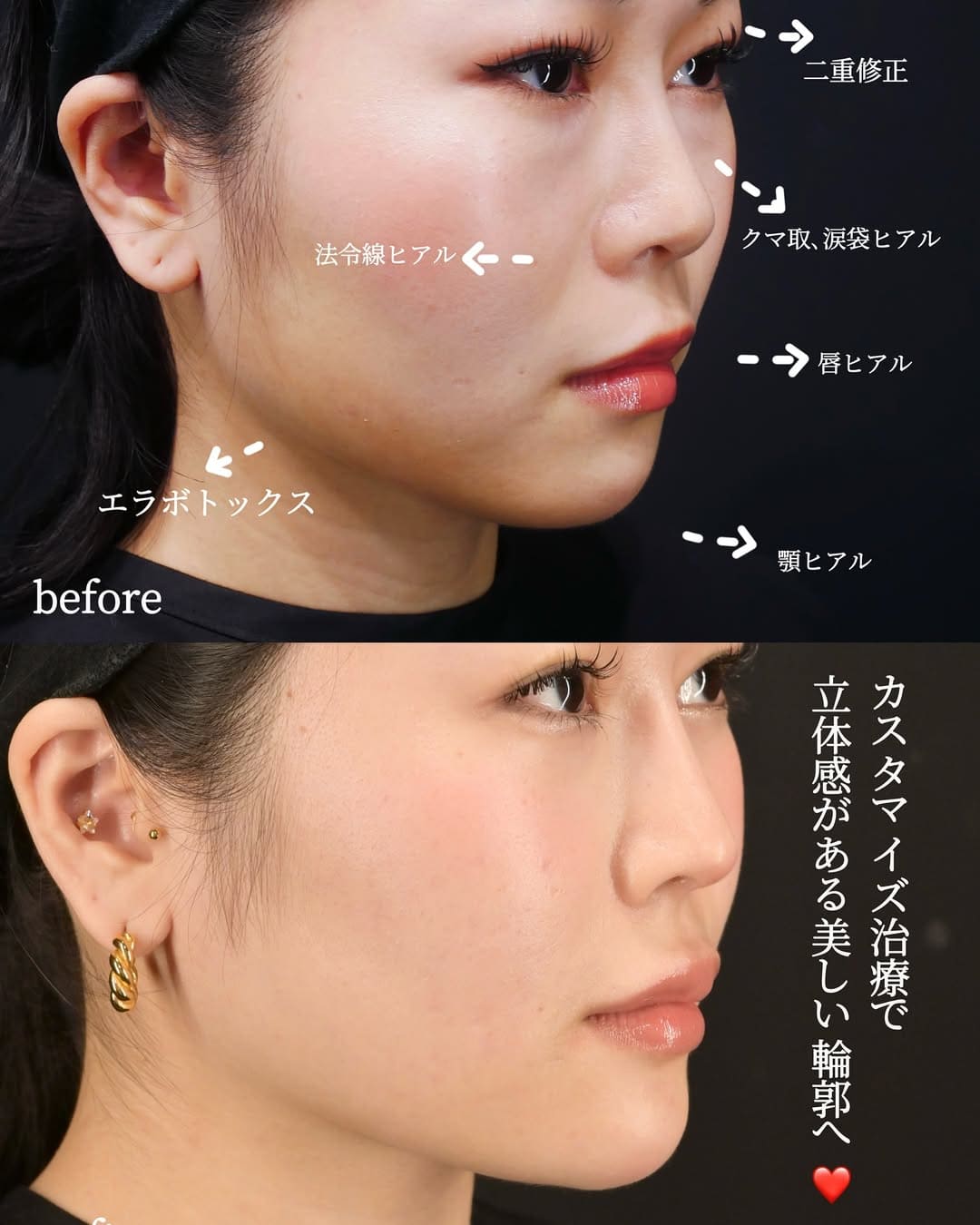 症例写真