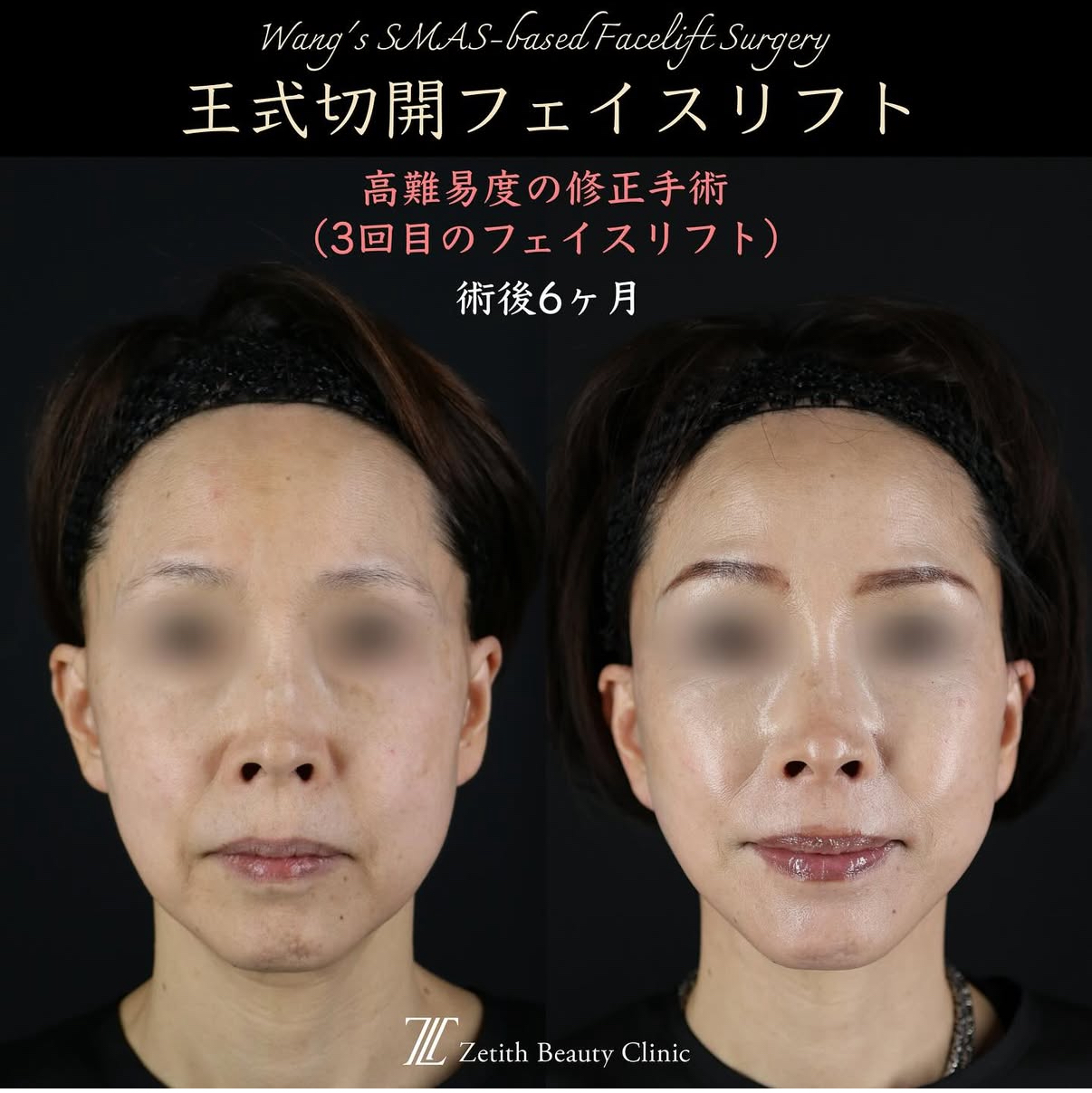 症例写真