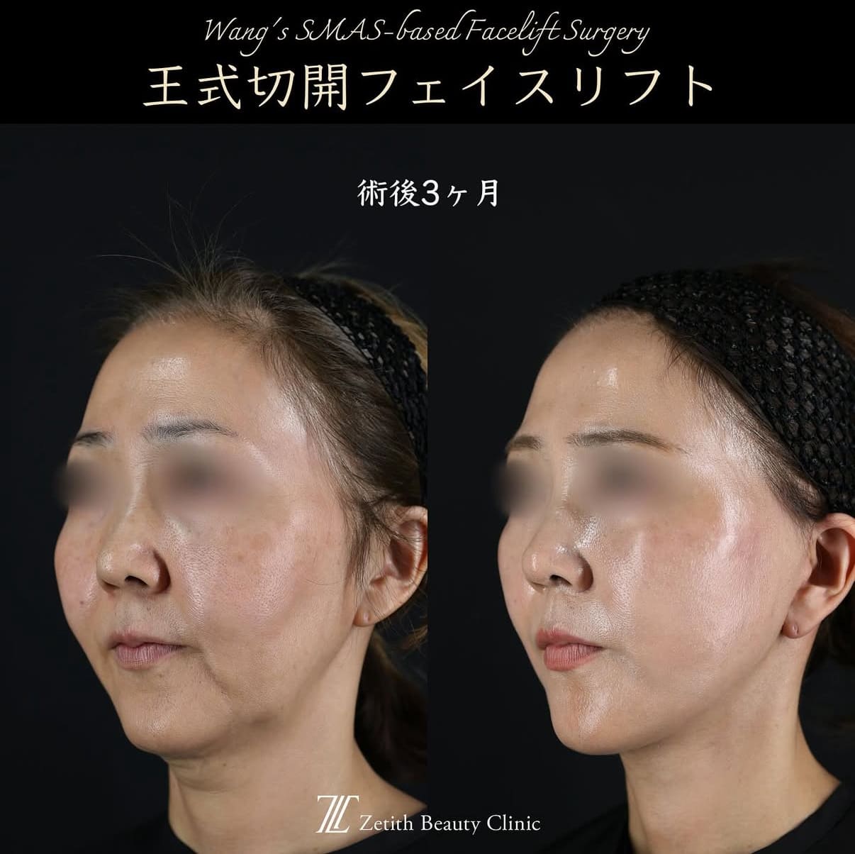 症例写真