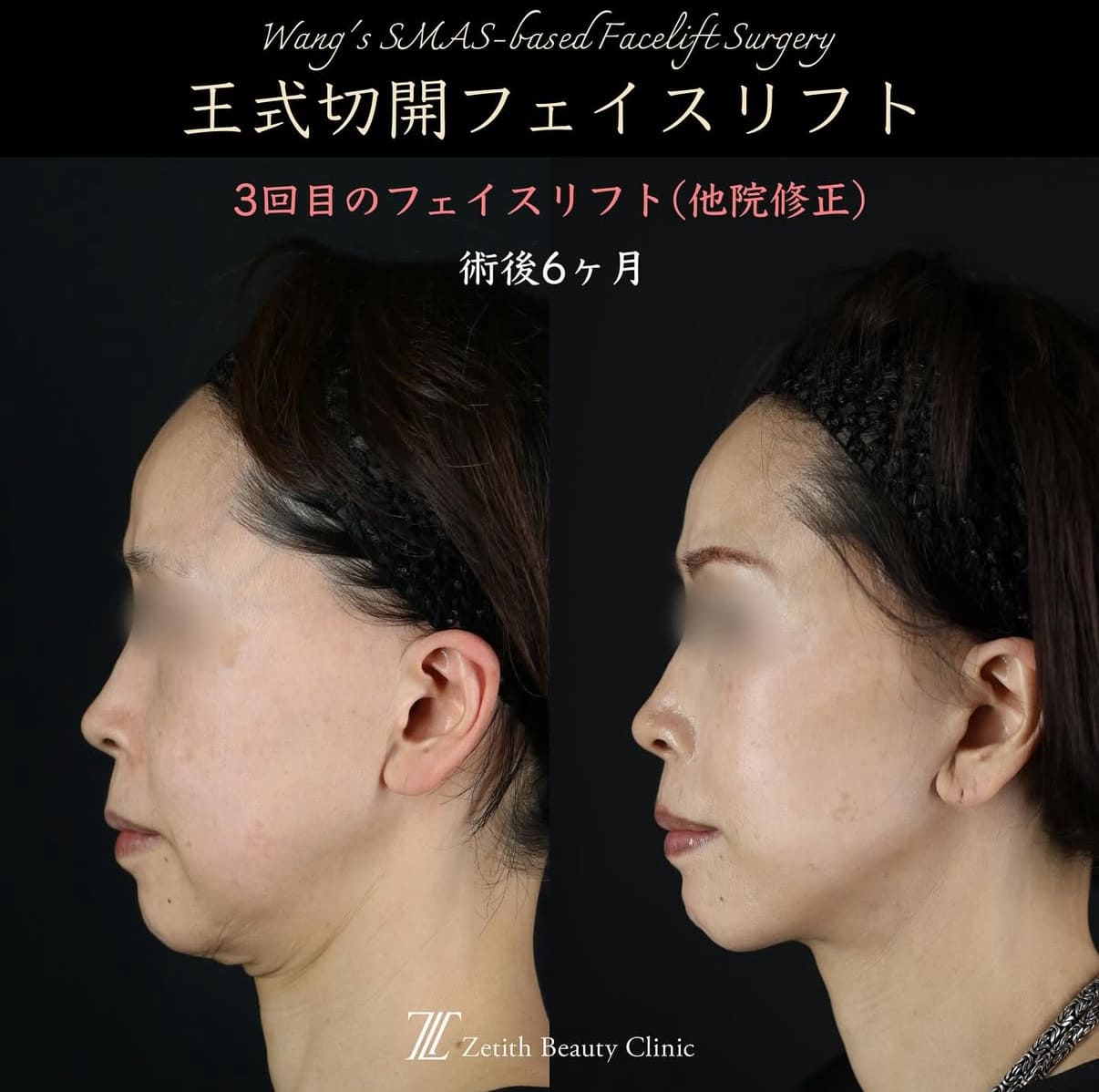 症例写真