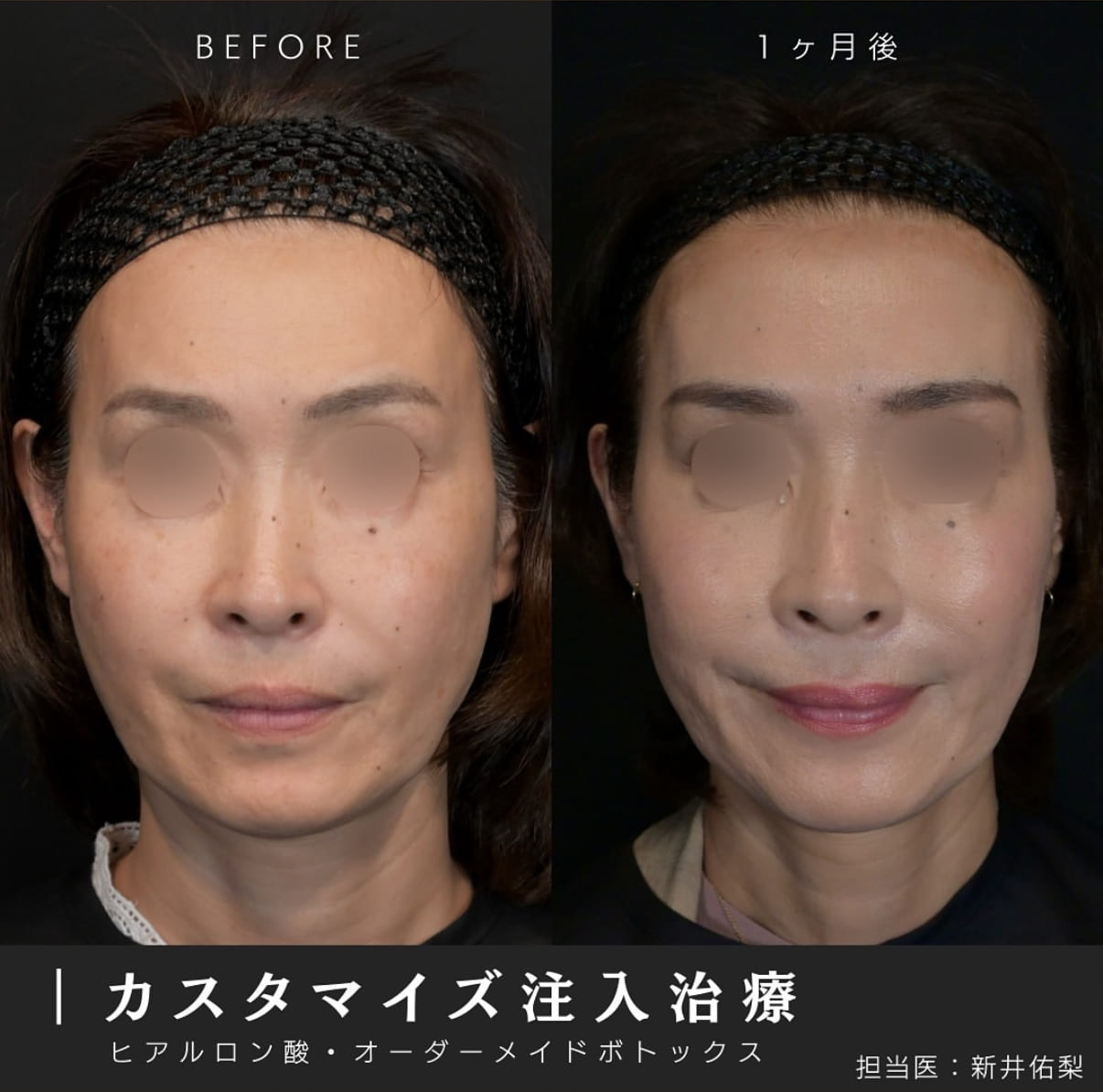 症例写真