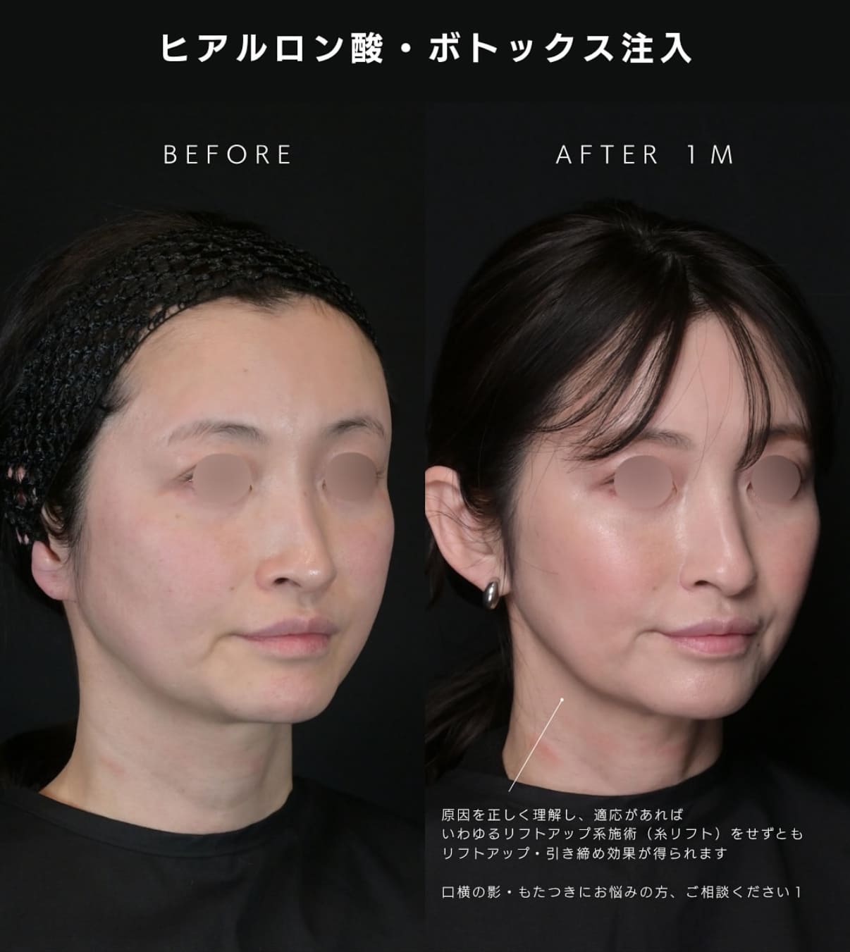 症例写真