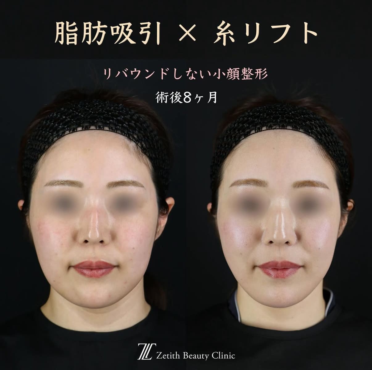 症例写真