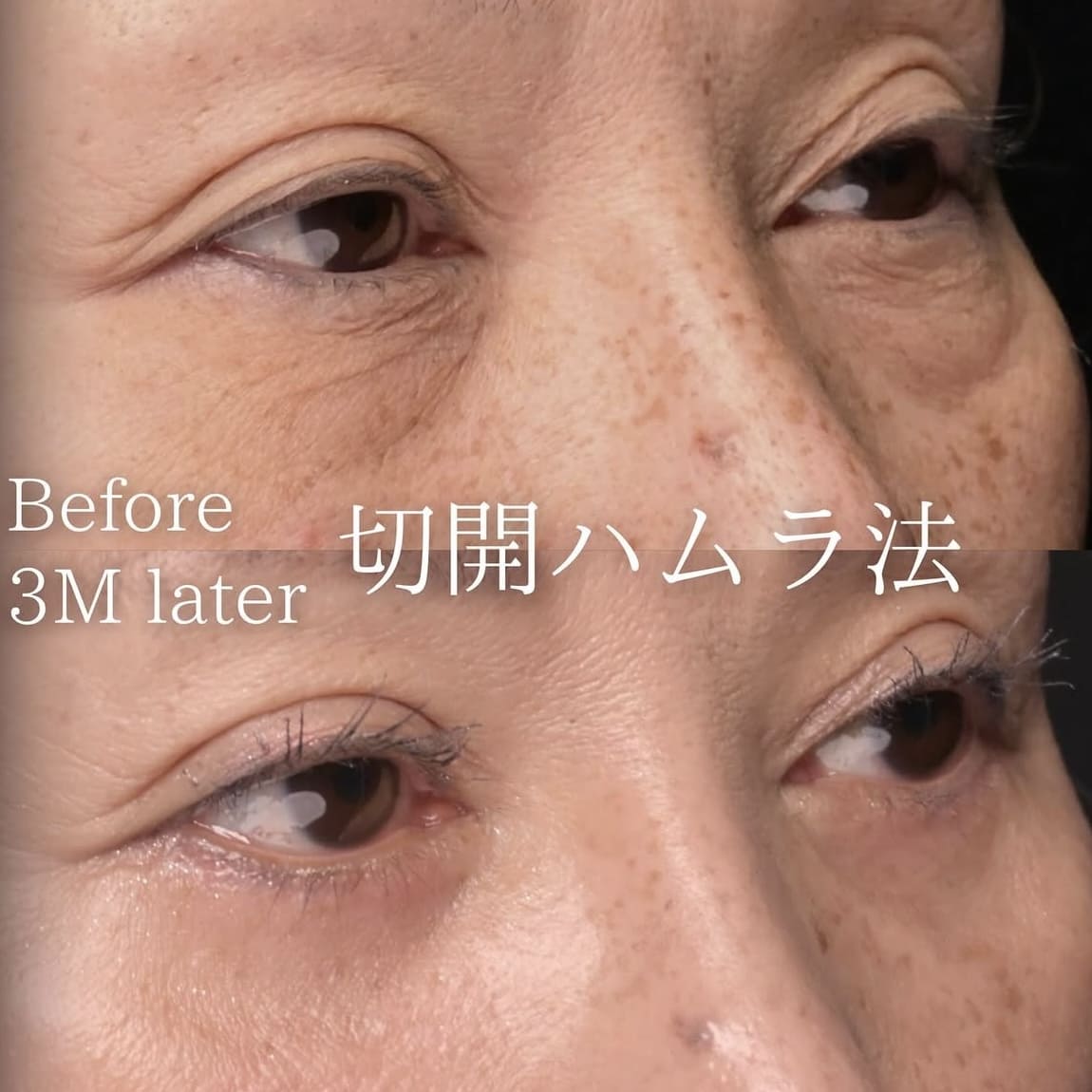 症例写真