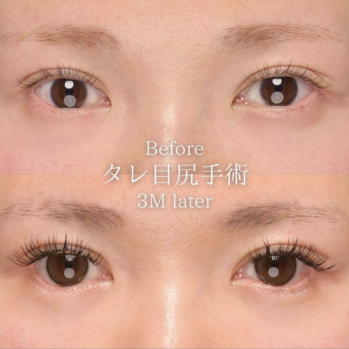 症例写真