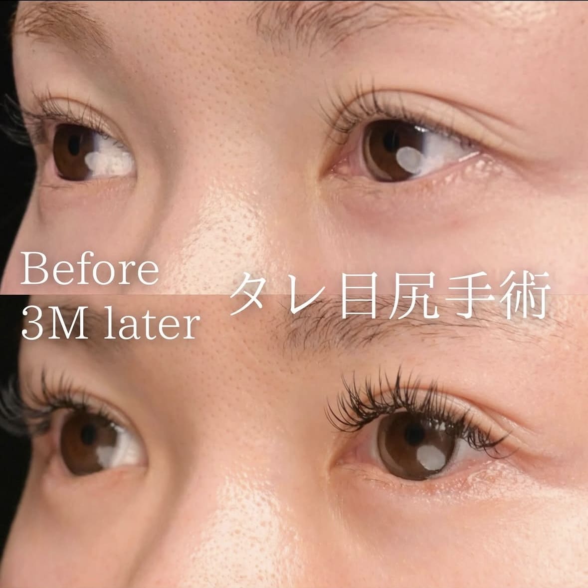 症例写真