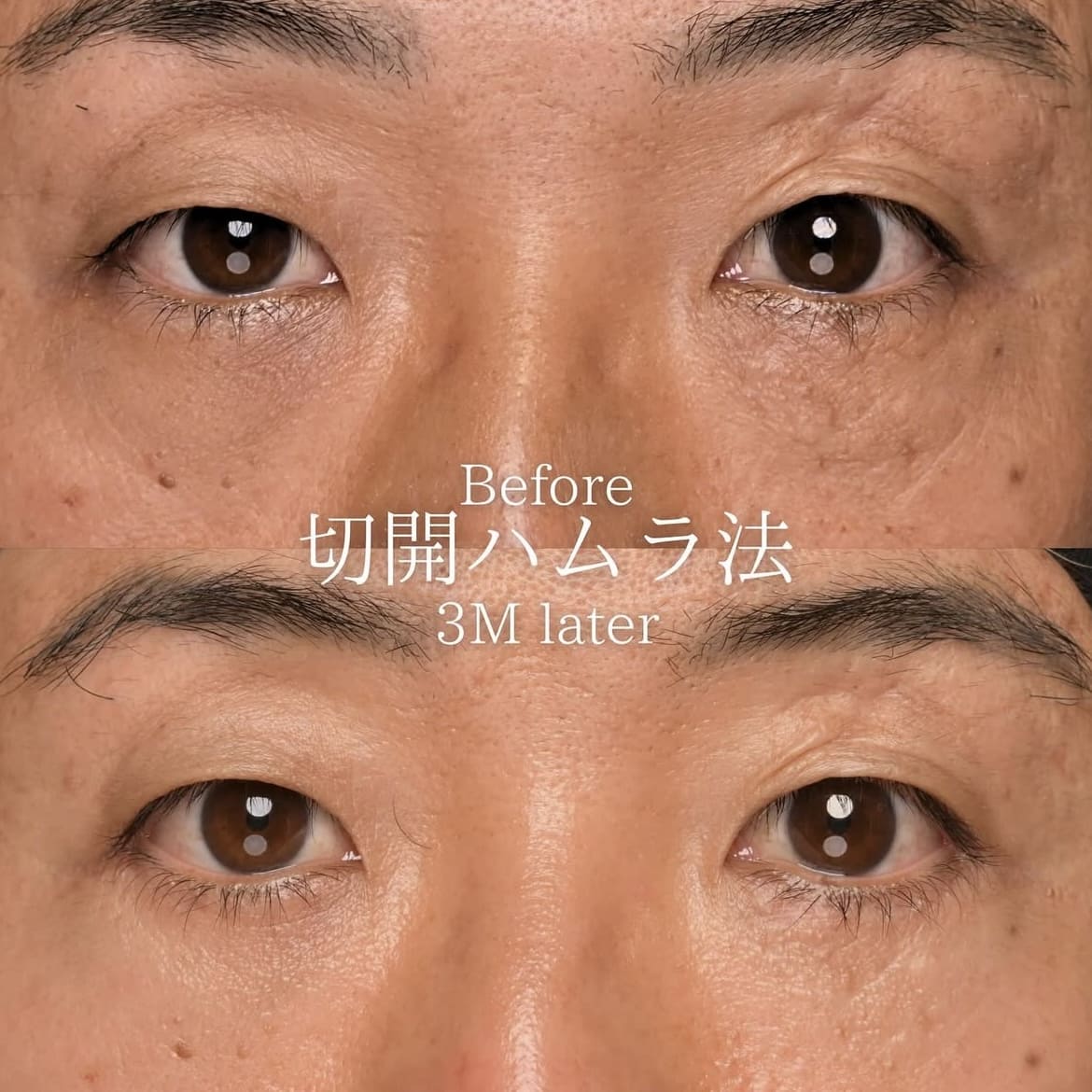 症例写真