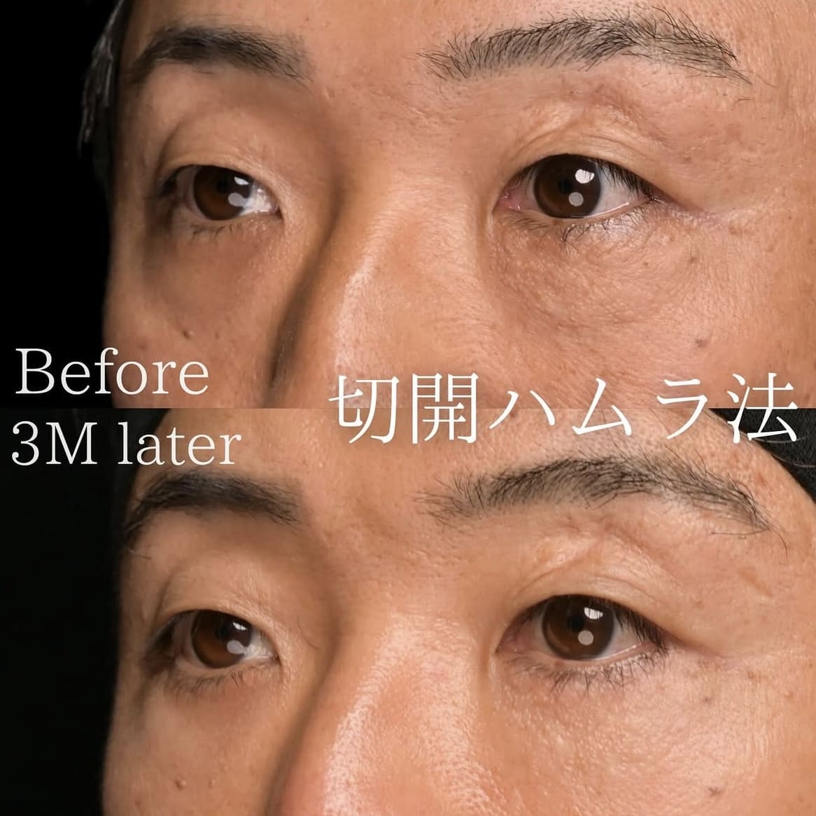 症例写真