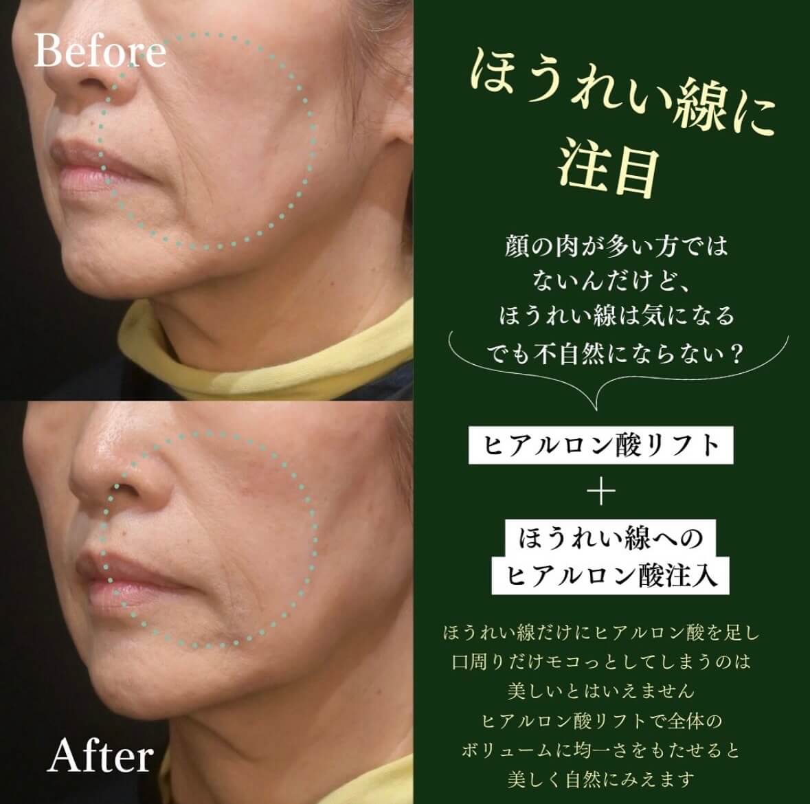 症例写真