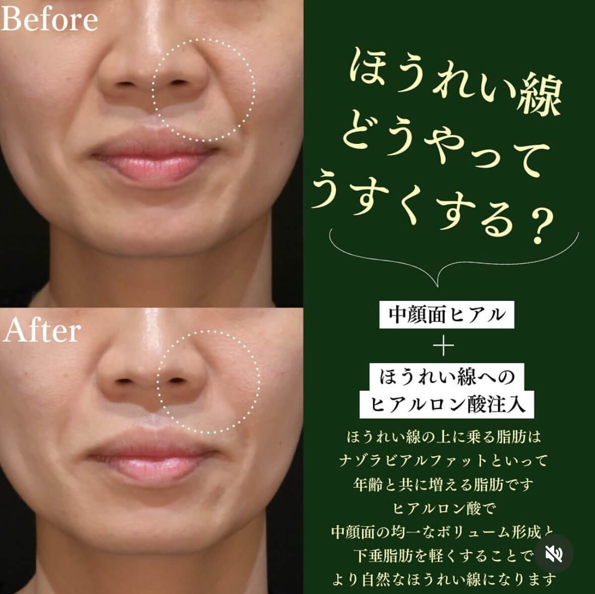 症例写真