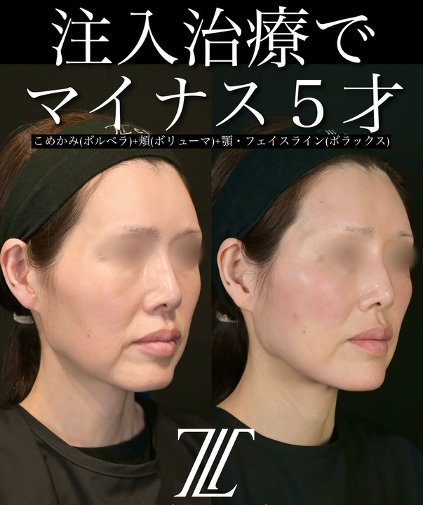症例写真