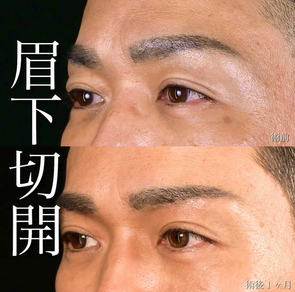 症例写真