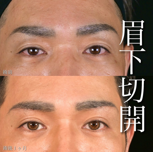 症例写真