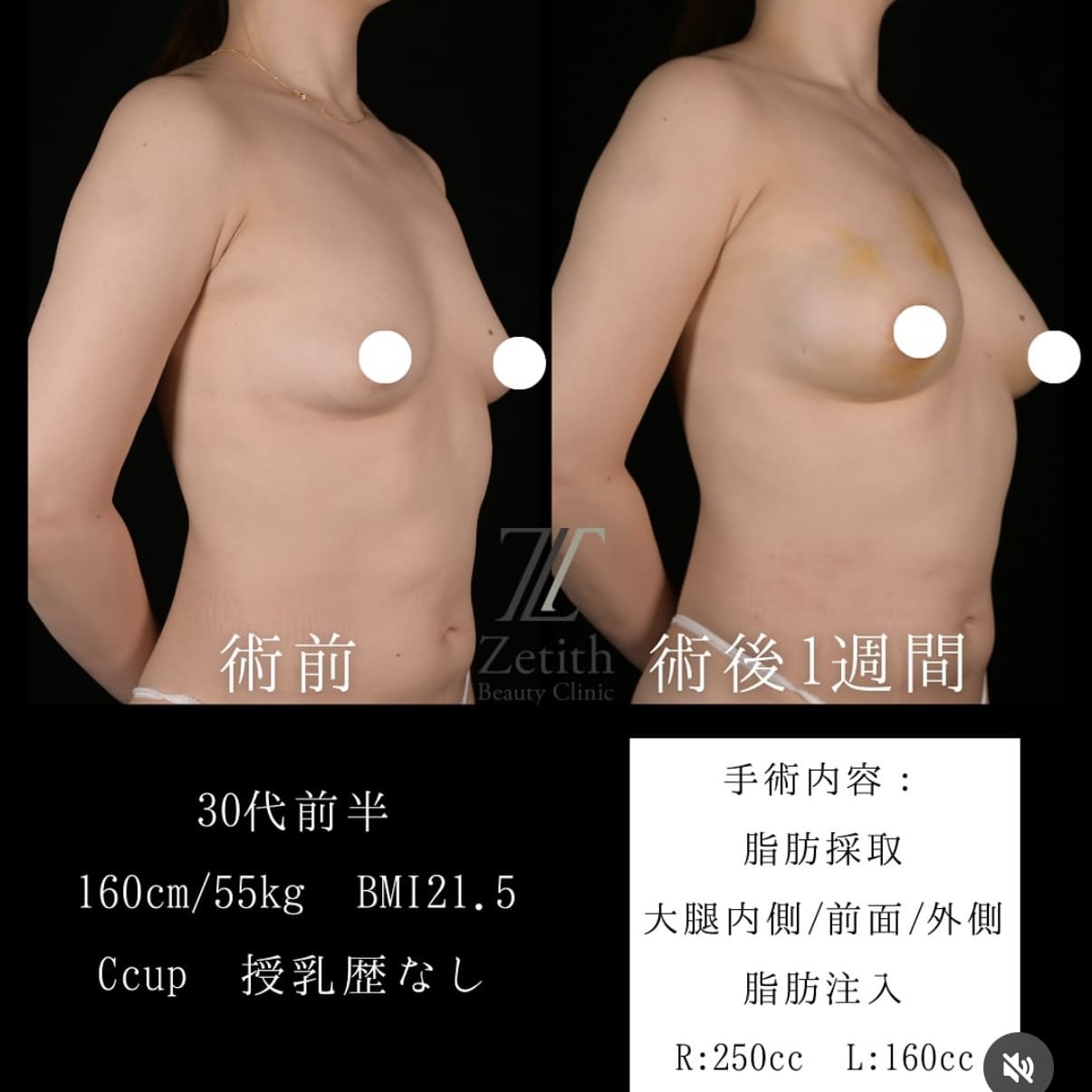 症例写真