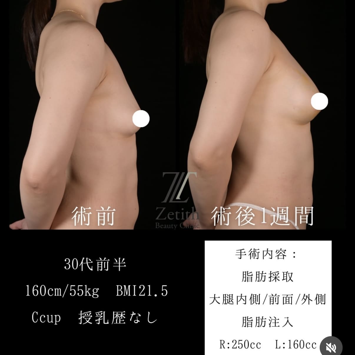 症例写真