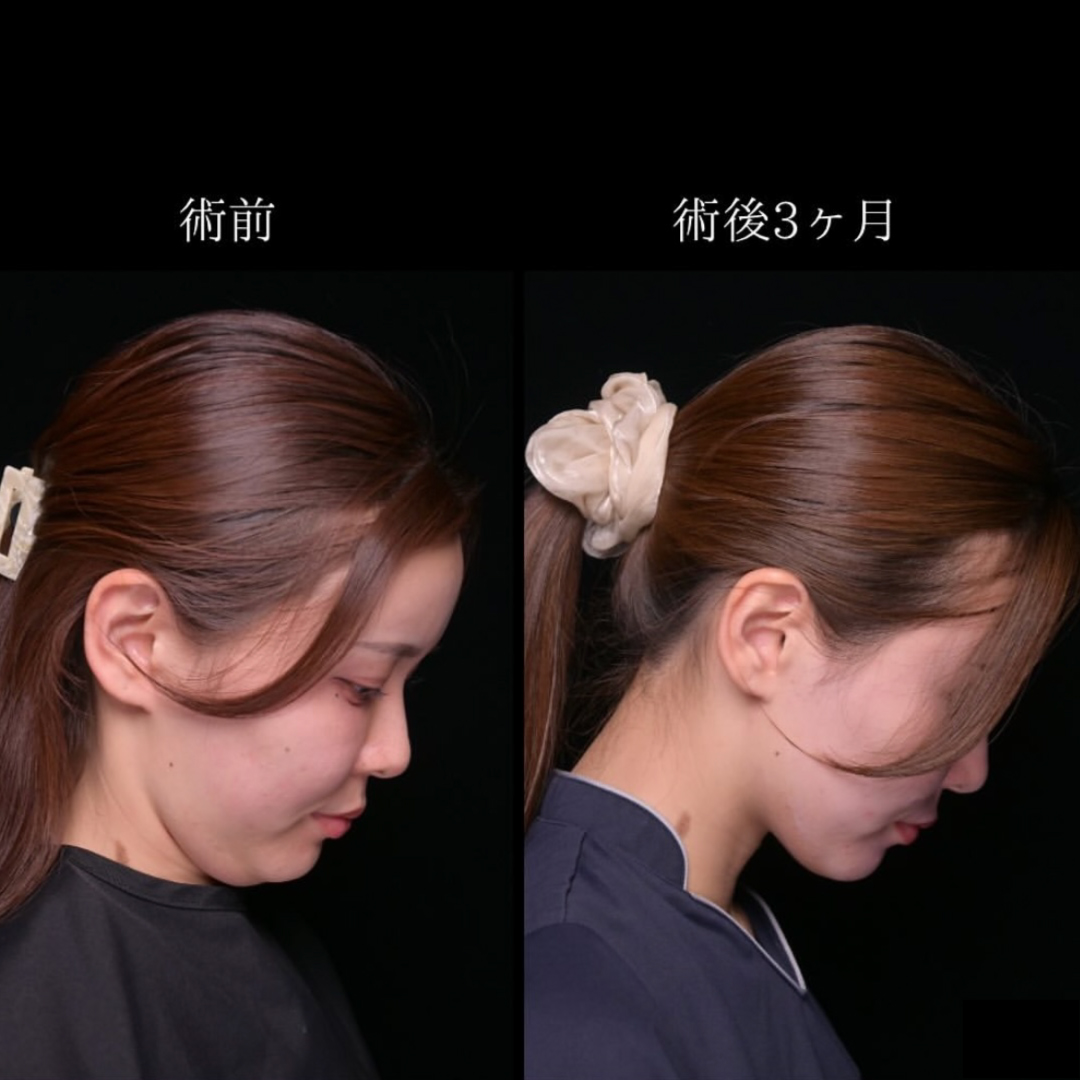 症例写真