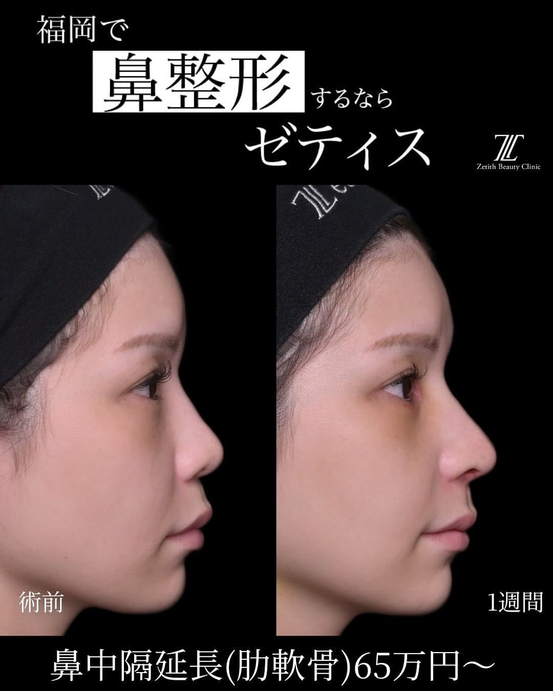 症例写真