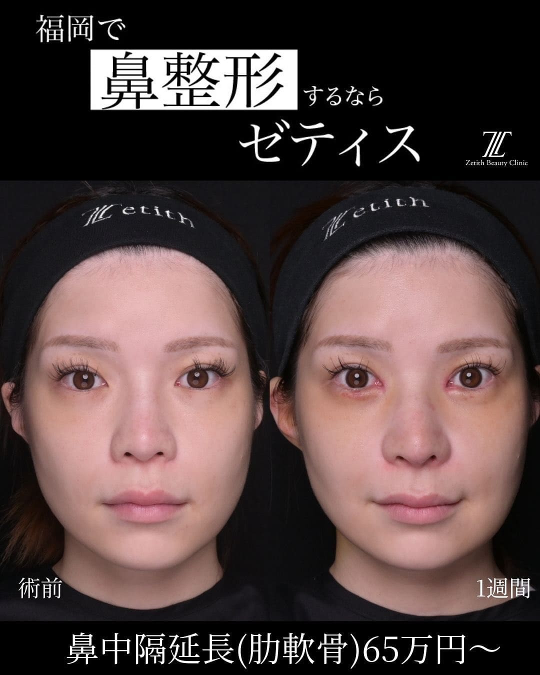 症例写真