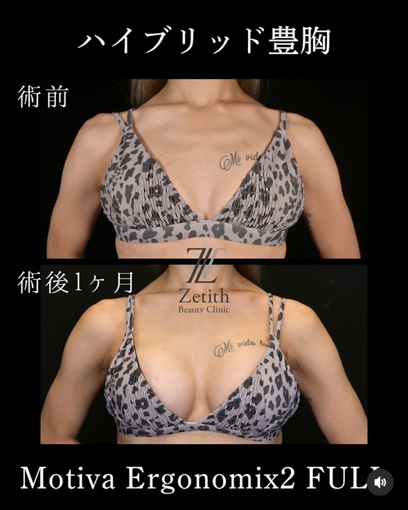 症例写真