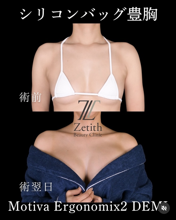 症例写真