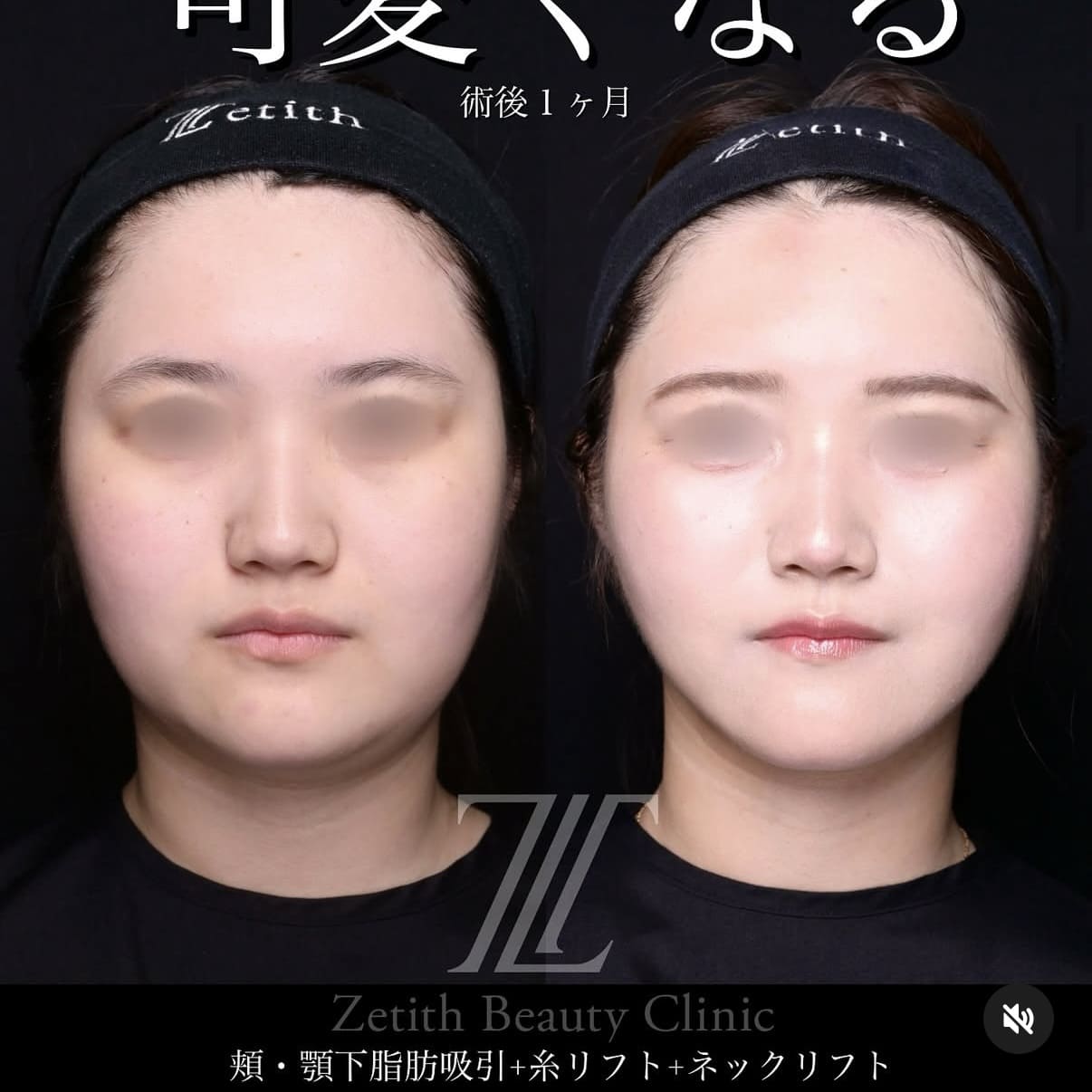 症例写真