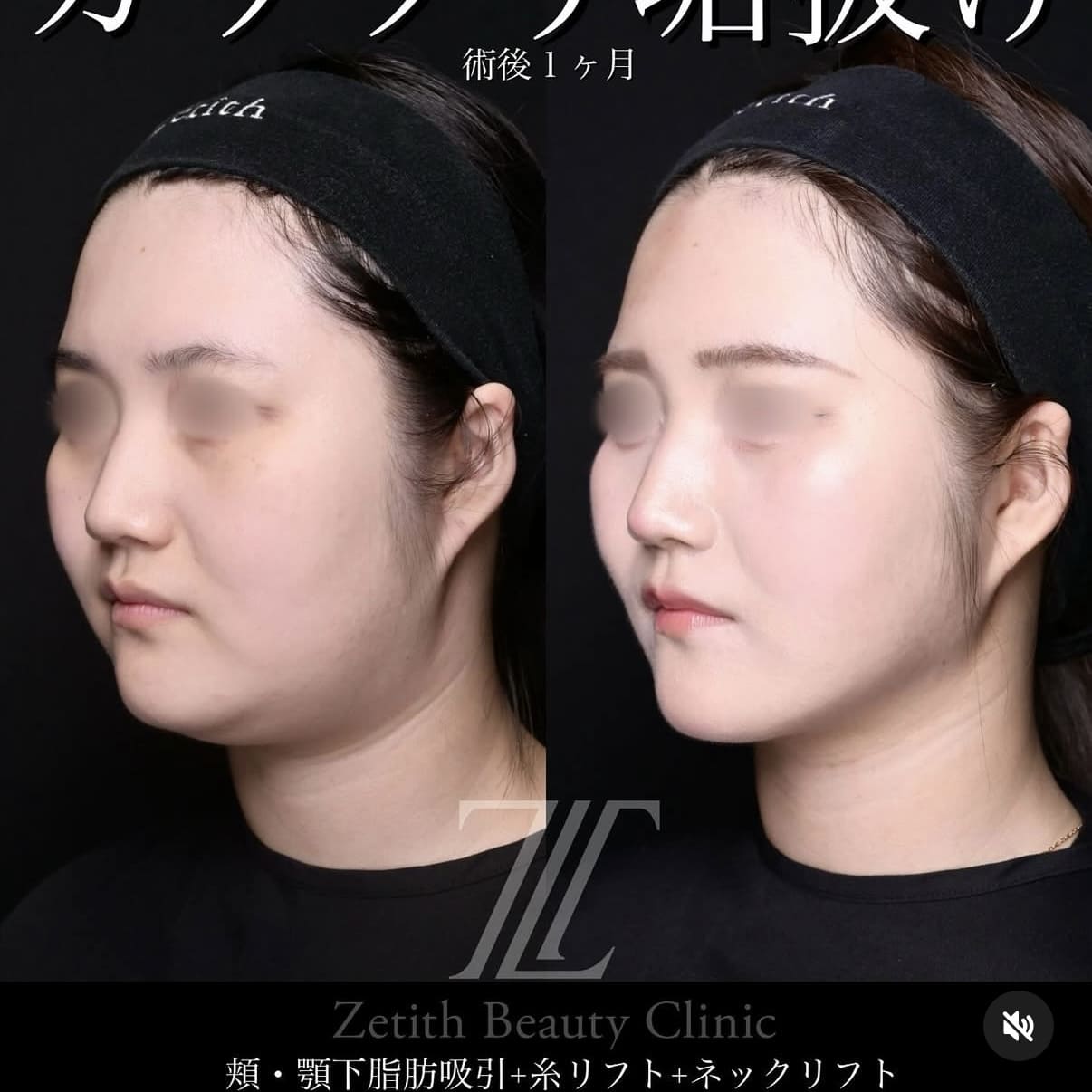 症例写真