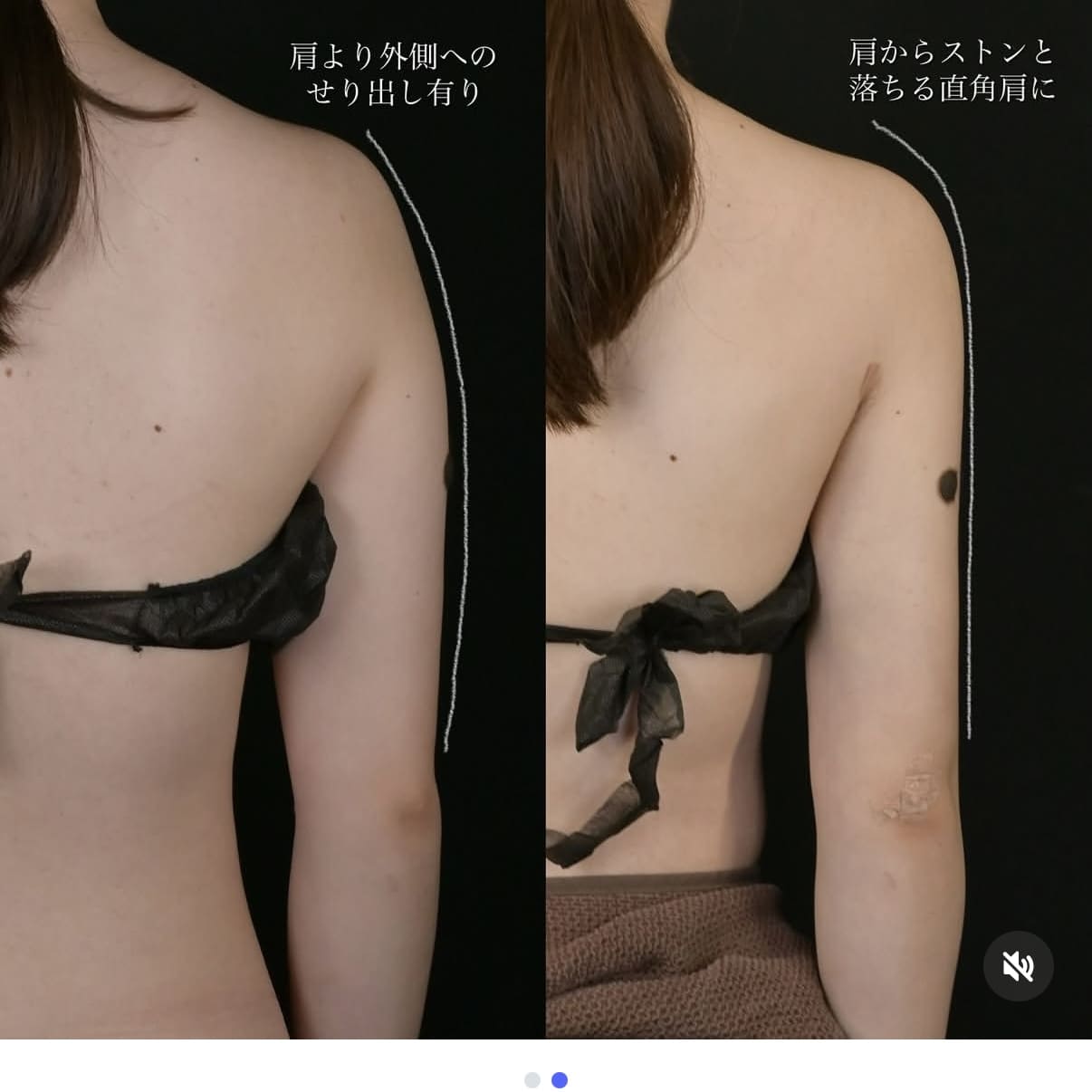 症例写真