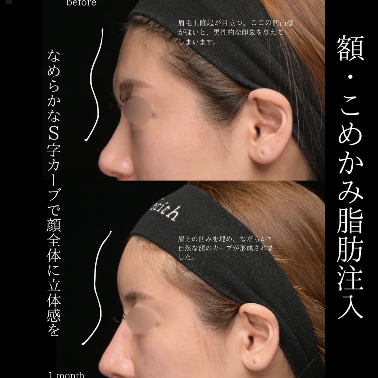 症例写真