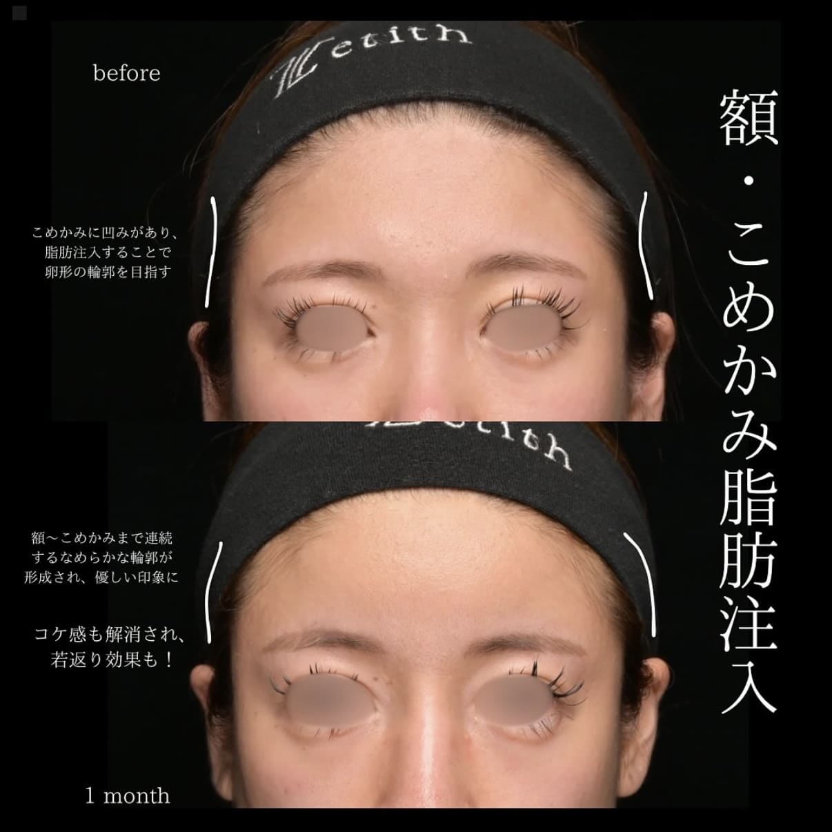 症例写真