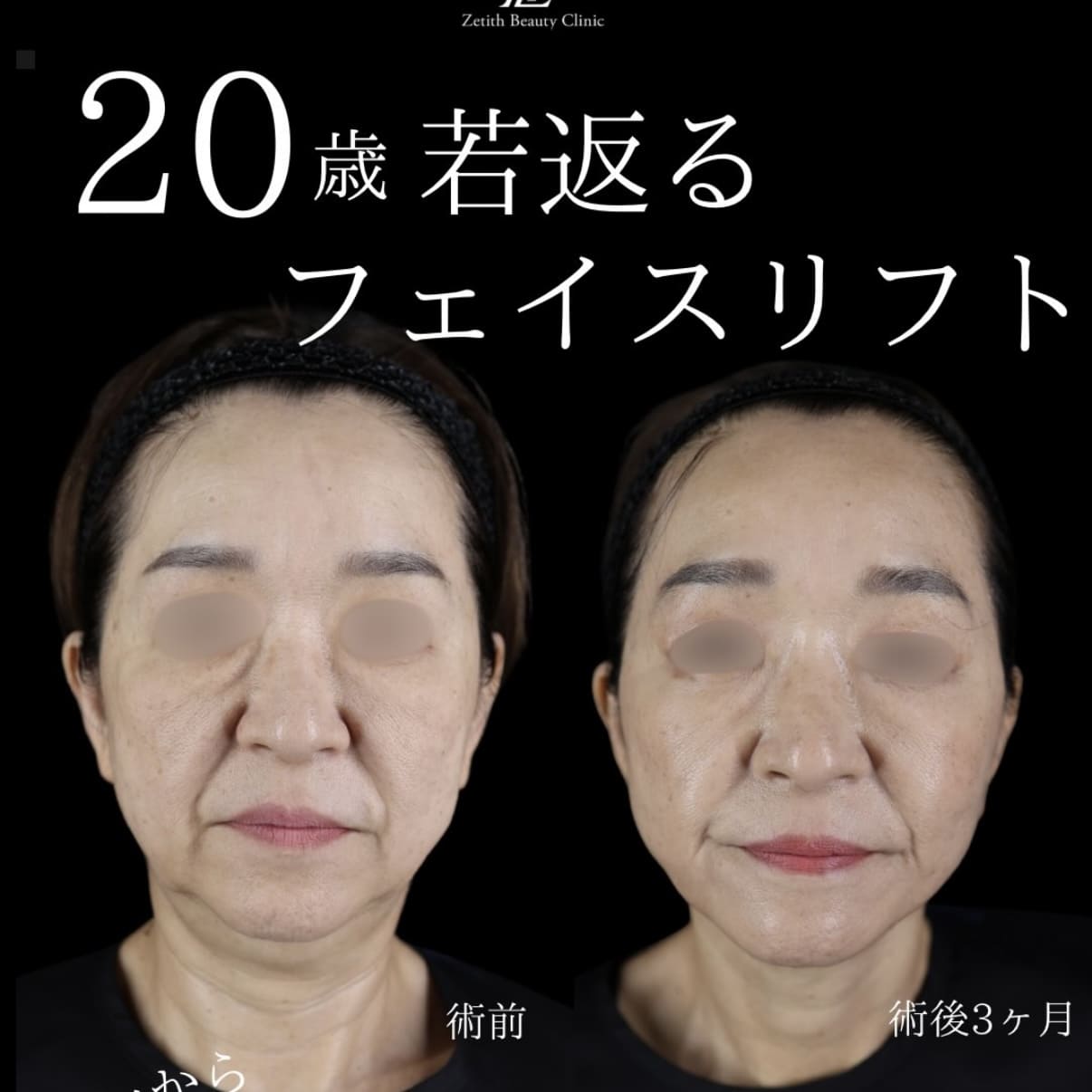 症例写真