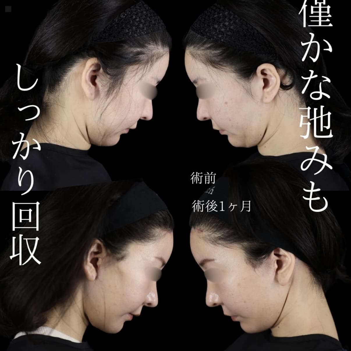 症例写真