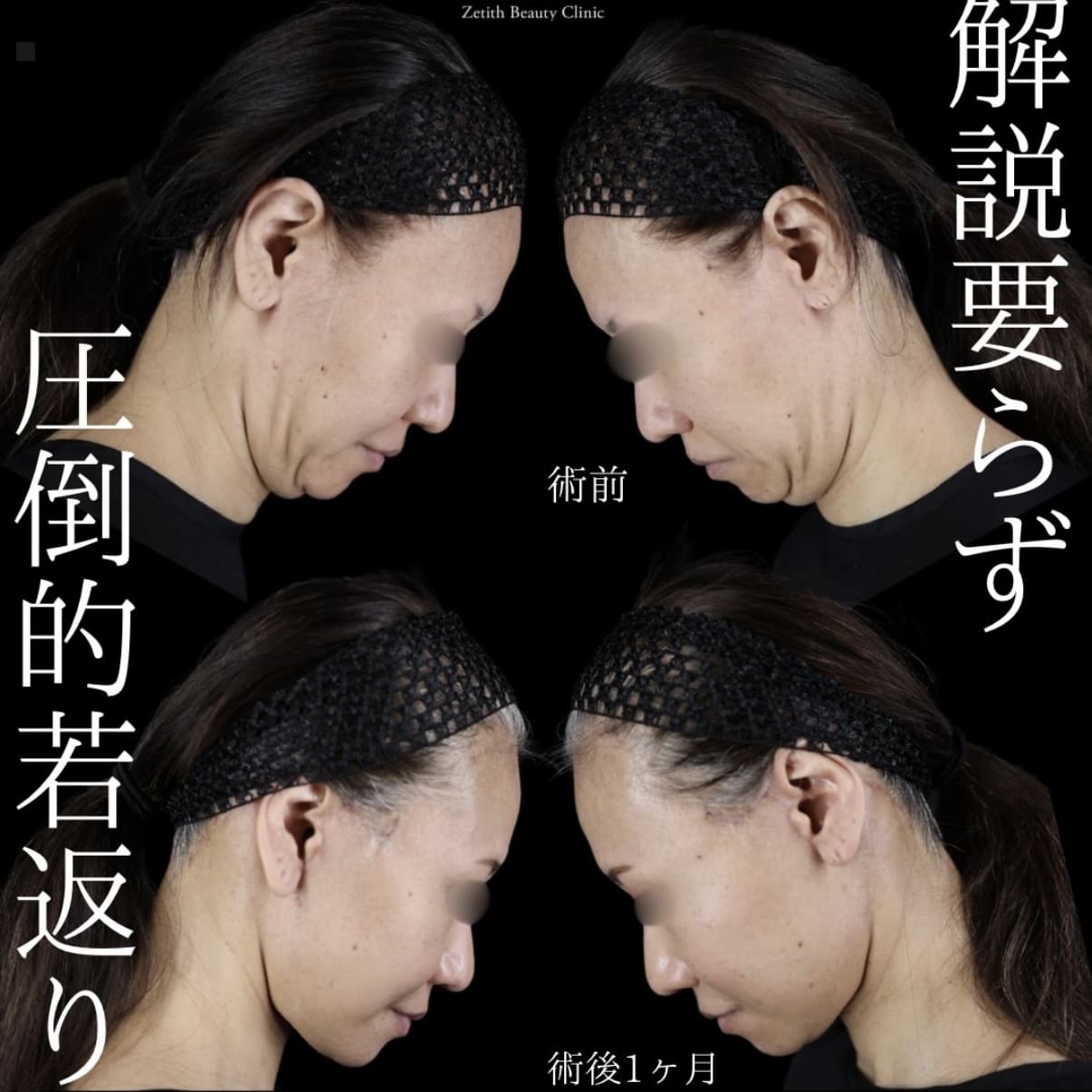 症例写真