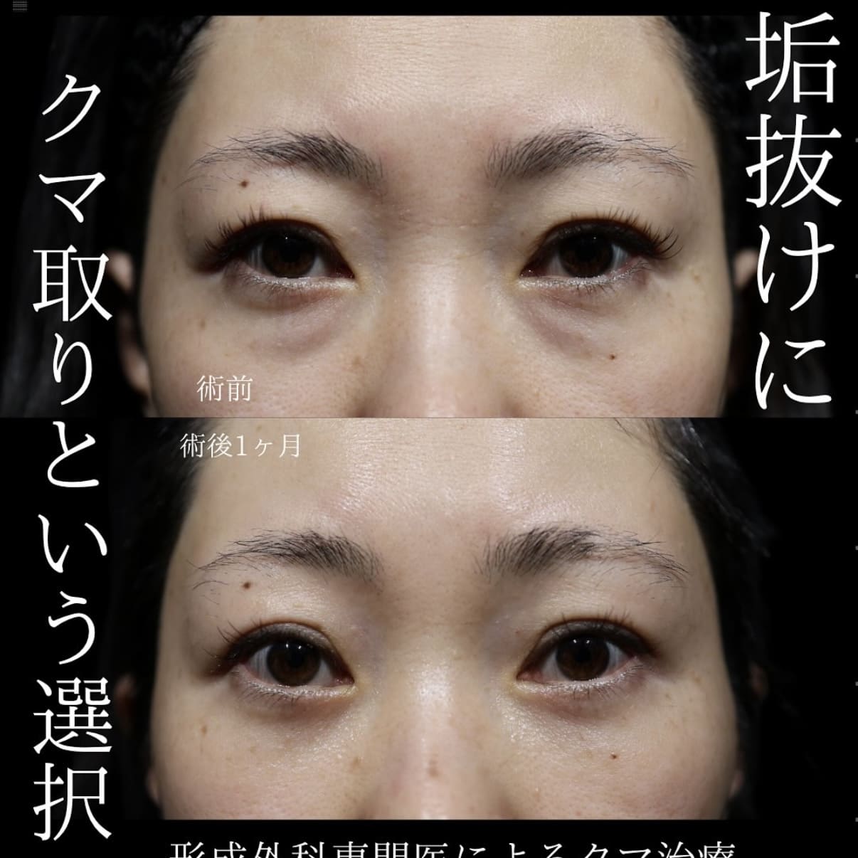 症例写真