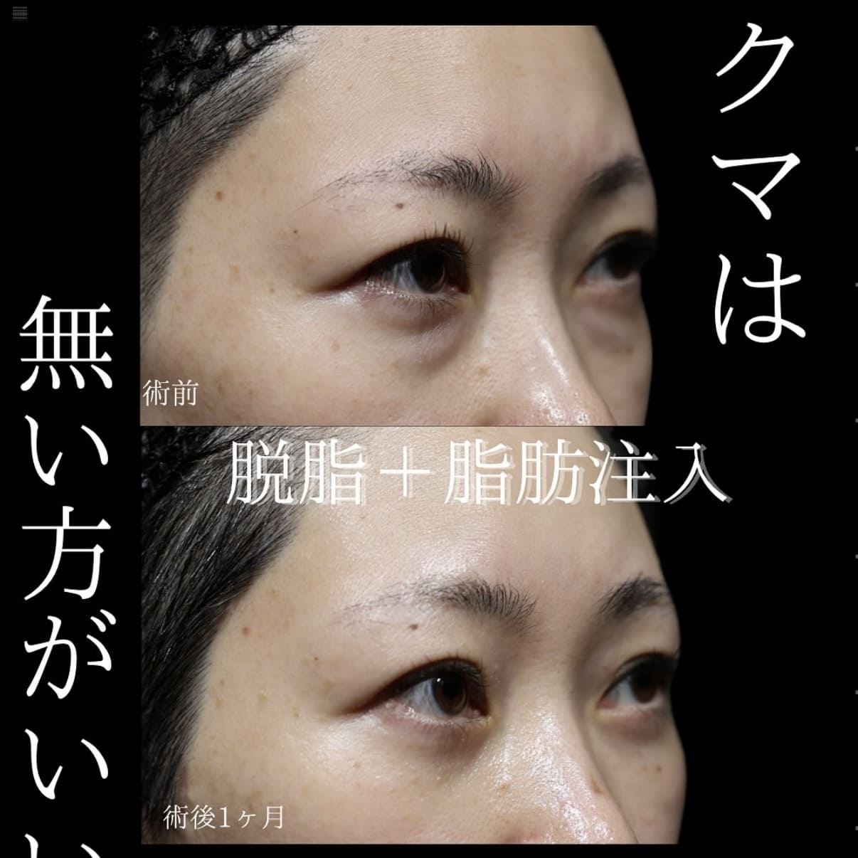 症例写真