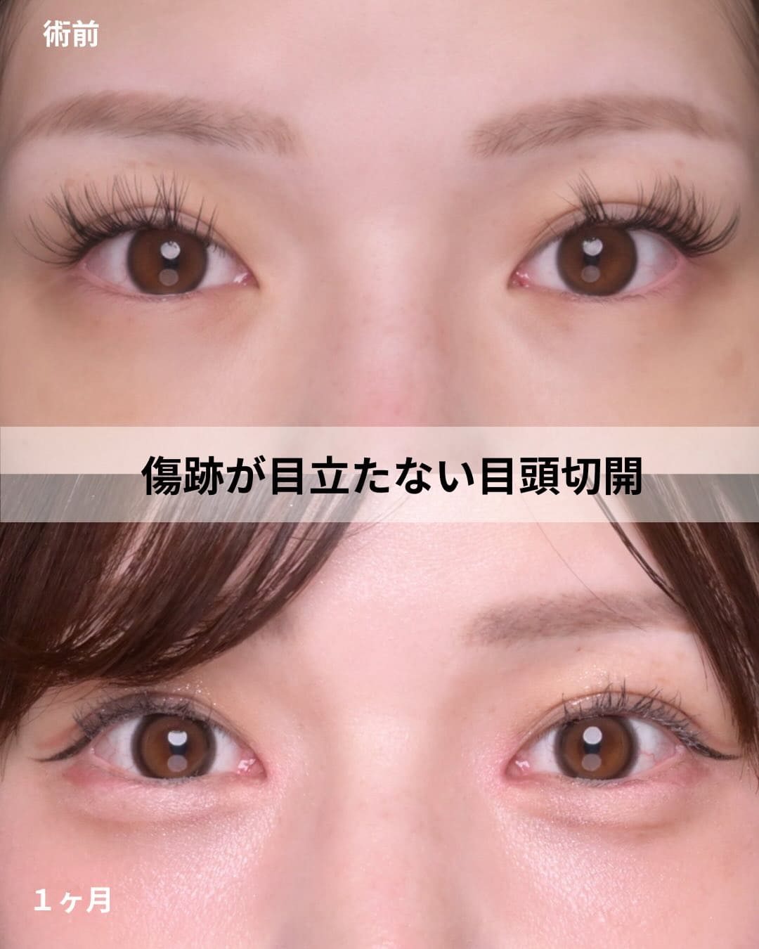 症例写真
