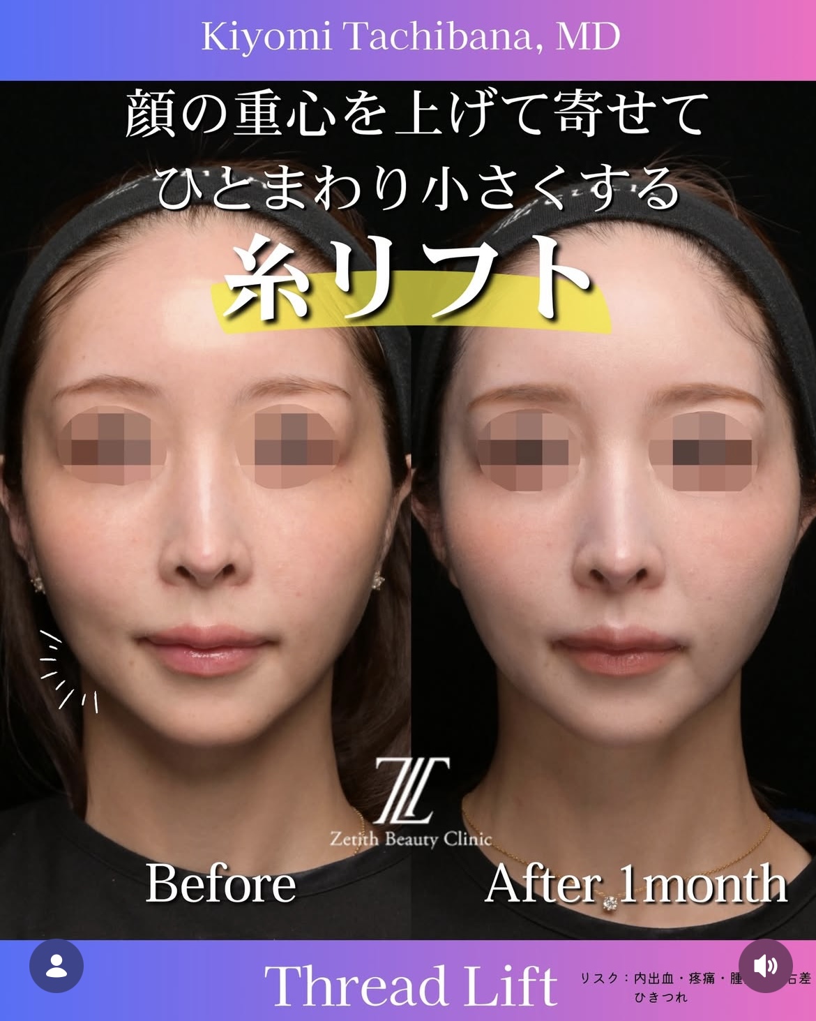 症例写真