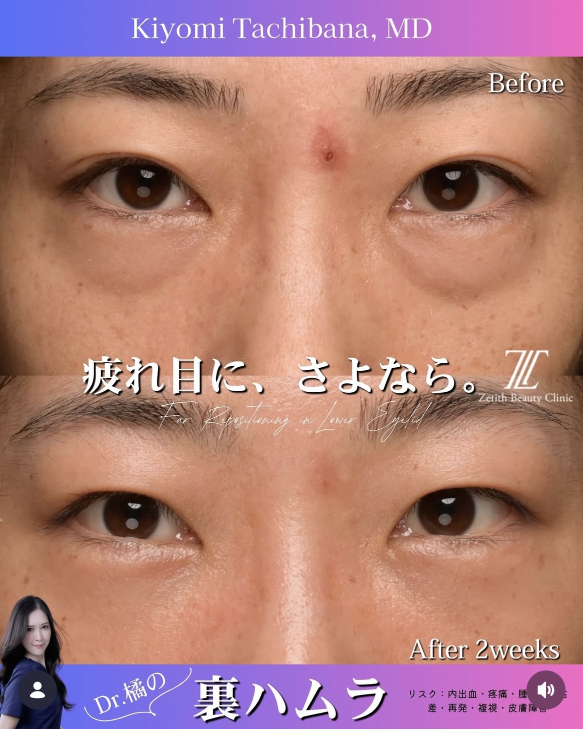 症例写真